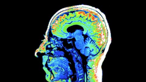 Il cervello, affascinante mistero: impariamo a conoscerlo