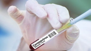 test sierologico coronavirus