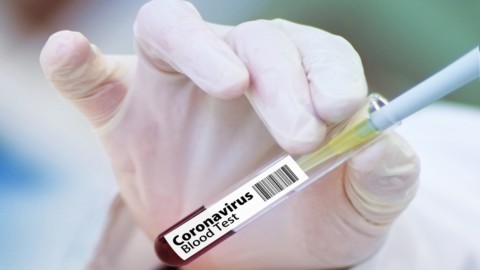 Covid-19, l’aumento dei contagi spaventa i mercati