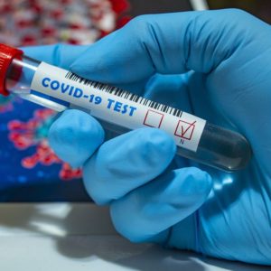 Borsa: Diasorin in rosso, pesa indagine su test sierologici