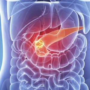 In Australia arriva il primo pancreas artificiale