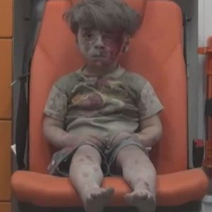 Síria, a criança ferida em Aleppo. VÍDEO