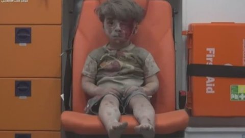 Síria, a criança ferida em Aleppo. VÍDEO